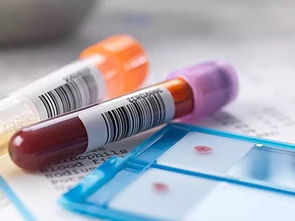 权威解读 医疗器械临床评价那些事儿｜医护人员防护用品